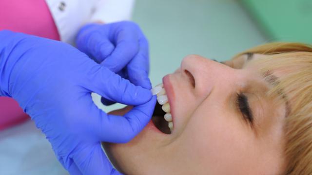 Dentist applying a veneer for patient