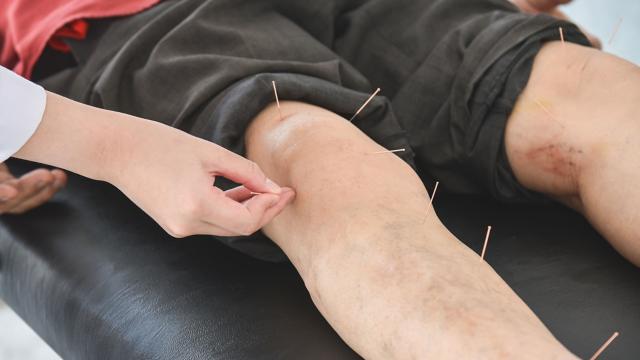Patient at doctor’s office receiving acupuncture on his leg.