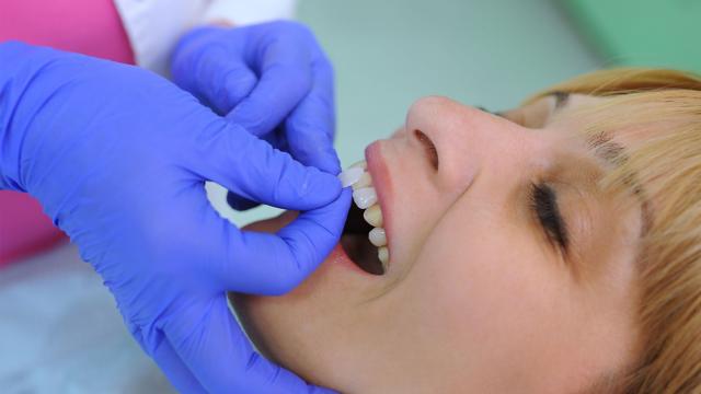 A patient is fitted for veneers.