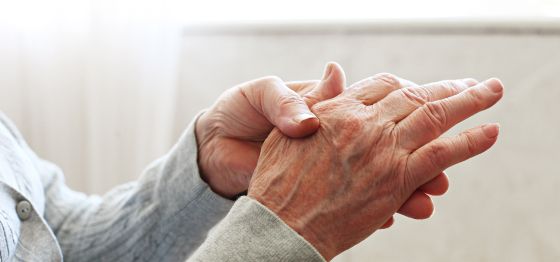 Keys to recognizing and treating rheumatoid arthritis